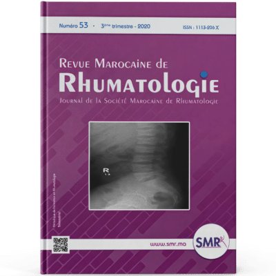 Revue Marocaine de Rhumatologie (N53, 2020)